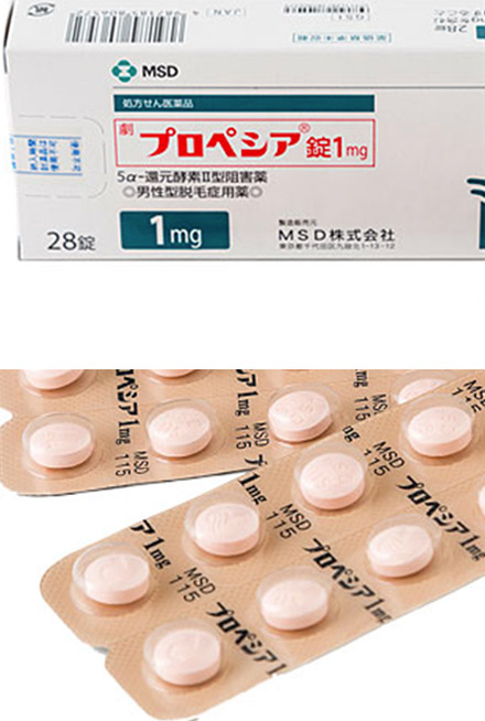 プロペシアで抜け毛の原因となる酵素を抑制
