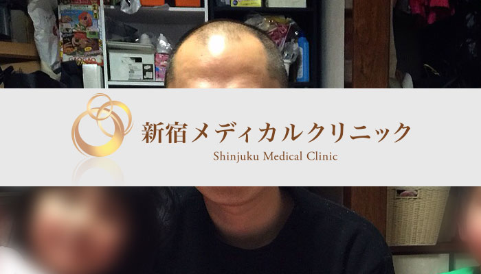 最初は正直「半信半疑」でした。